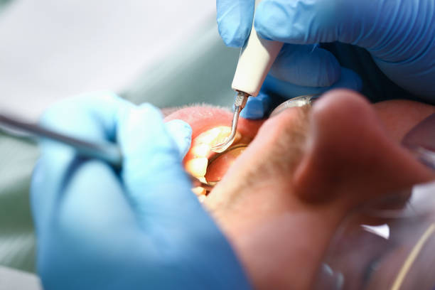 Best Tooth Pain Emergency Relief  in West Liberty, OH