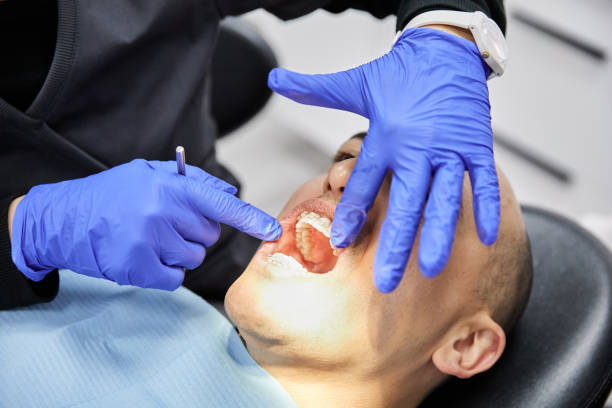 Best Teeth Whitening  in West Liberty, OH